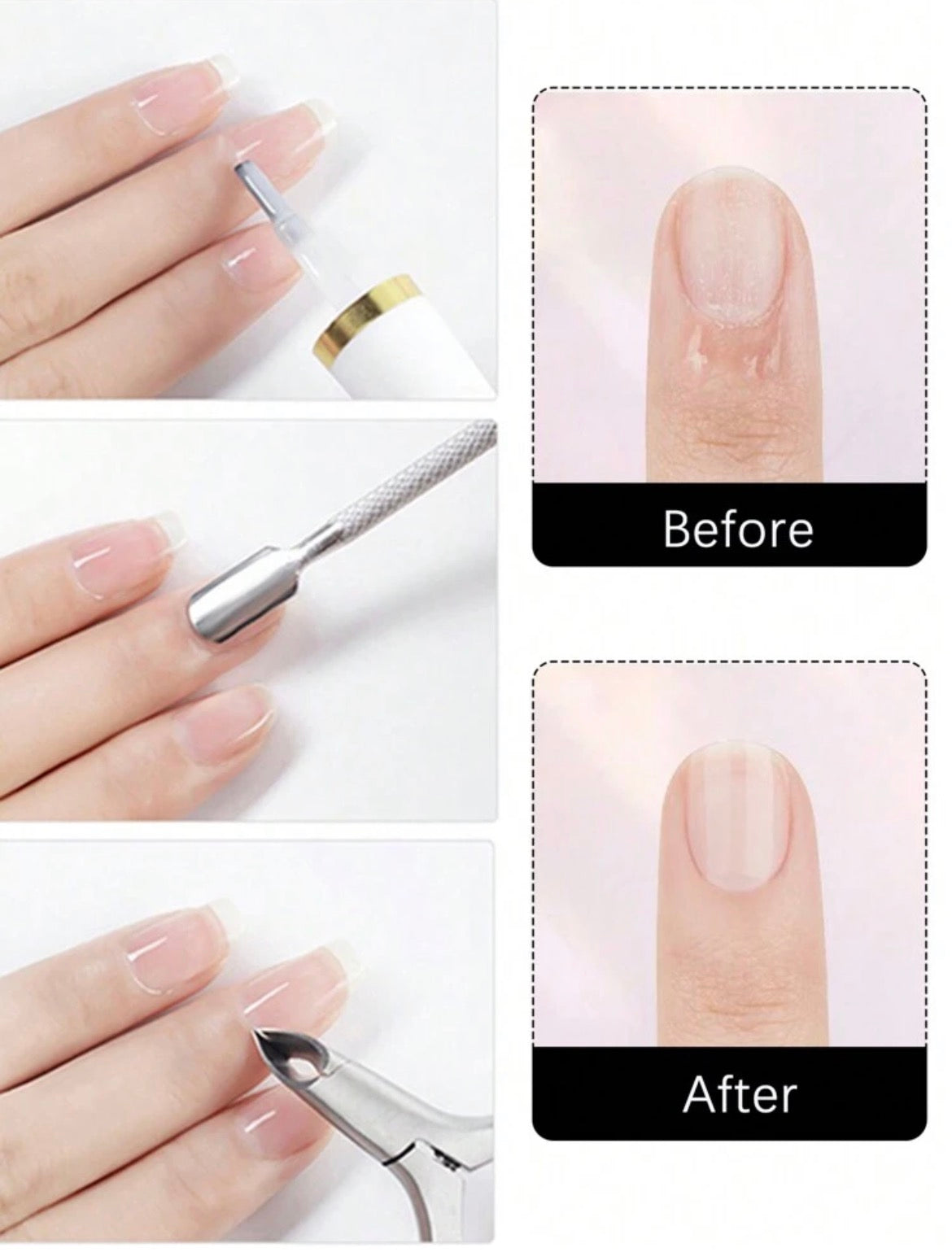 Nail Cuticle Remover | Softening Gel for Dry Cuticles